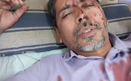 Principal Attacks Teacher with Steel Rod.