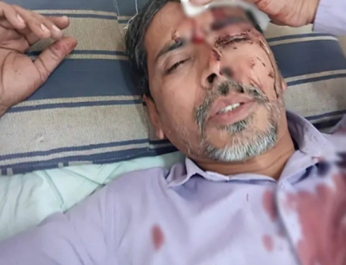 Principal Attacks Teacher with Steel Rod.